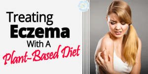 Treating Eczema With A Plant Based Diet Healing Through Movement